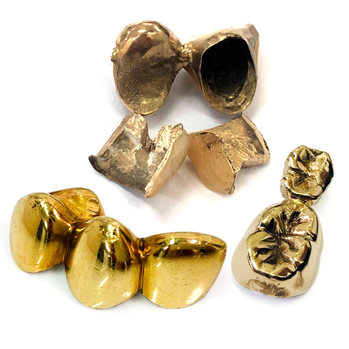 gold teeth